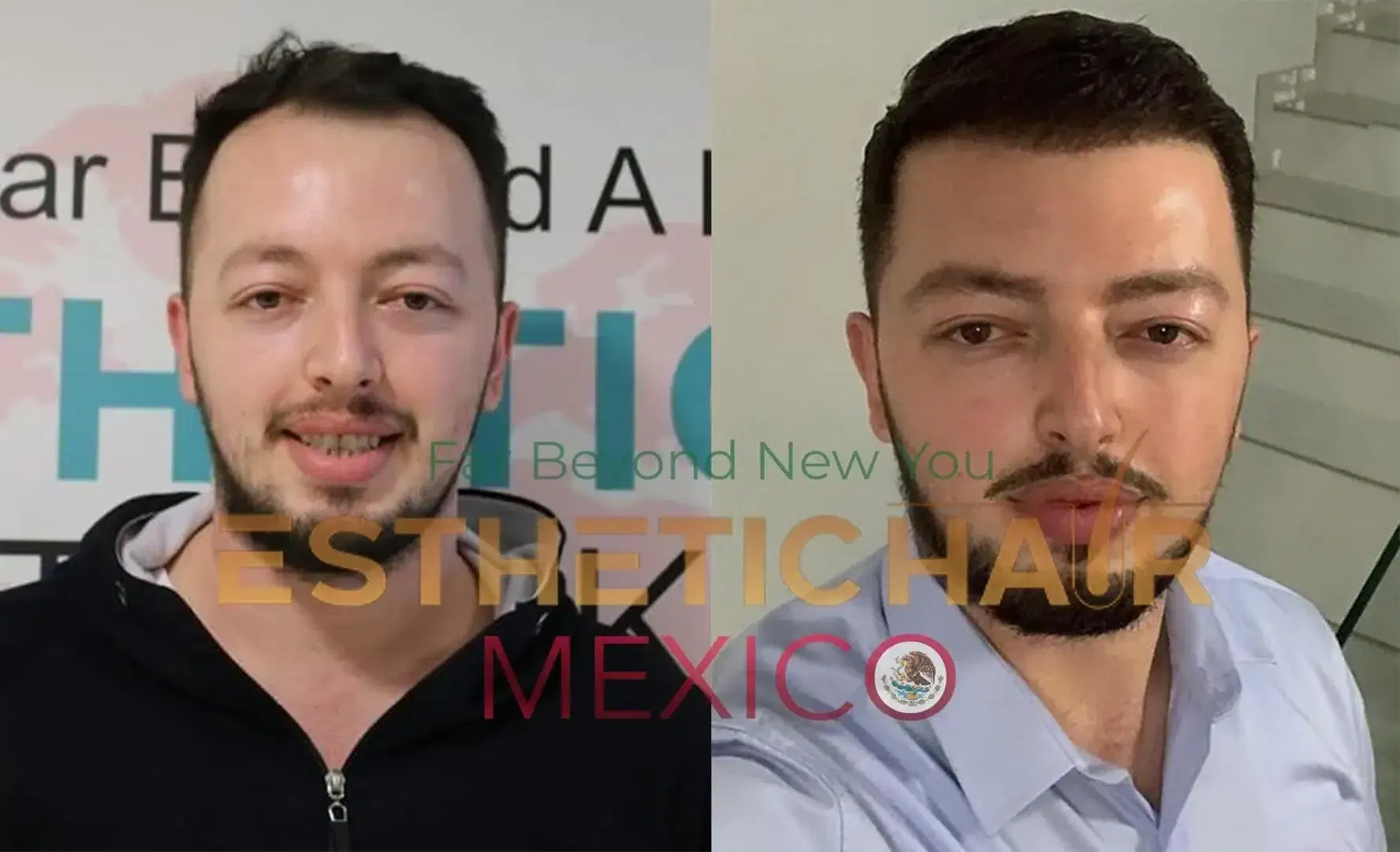 About Us Esthetic Hair