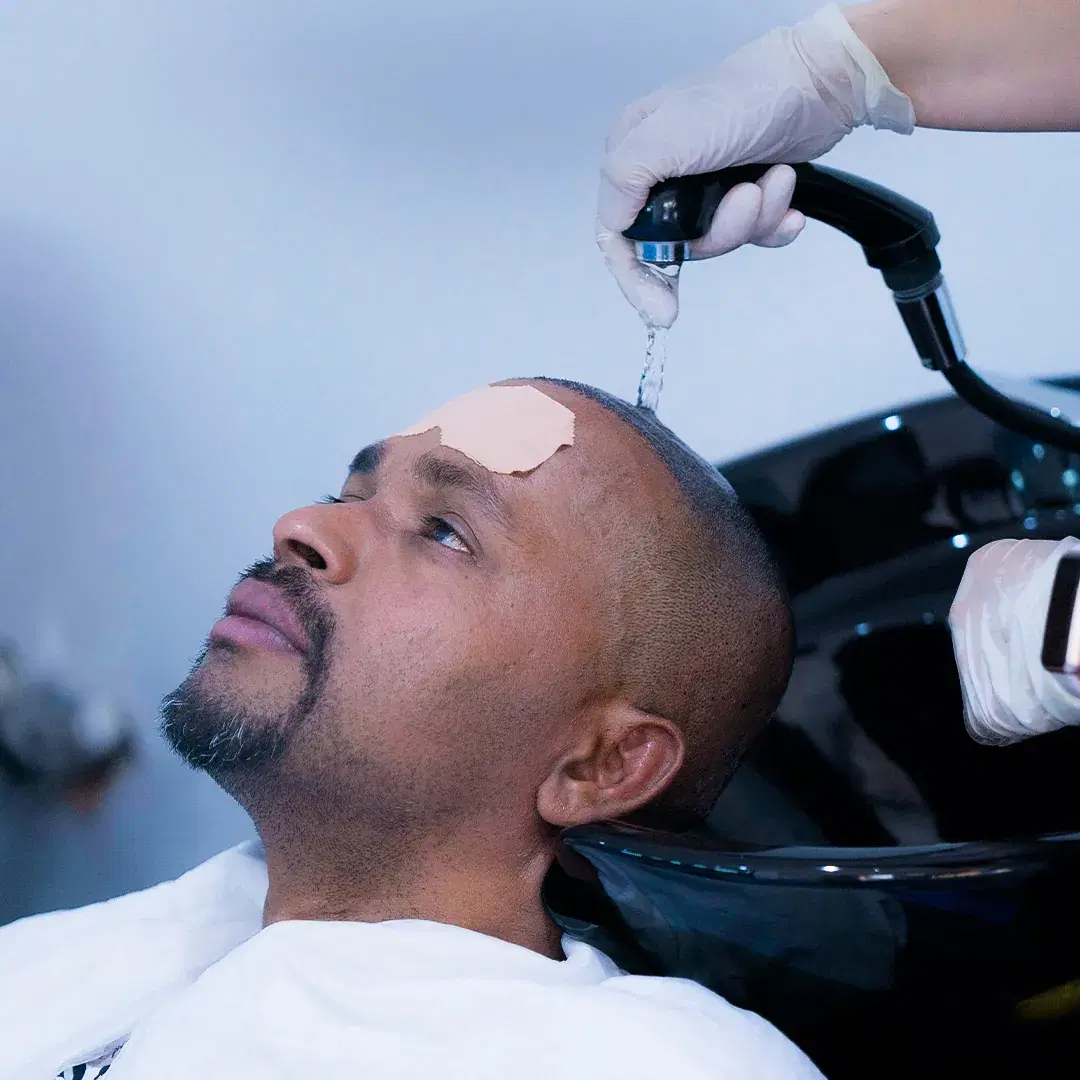 Hair Wash After Hair Transplant ?