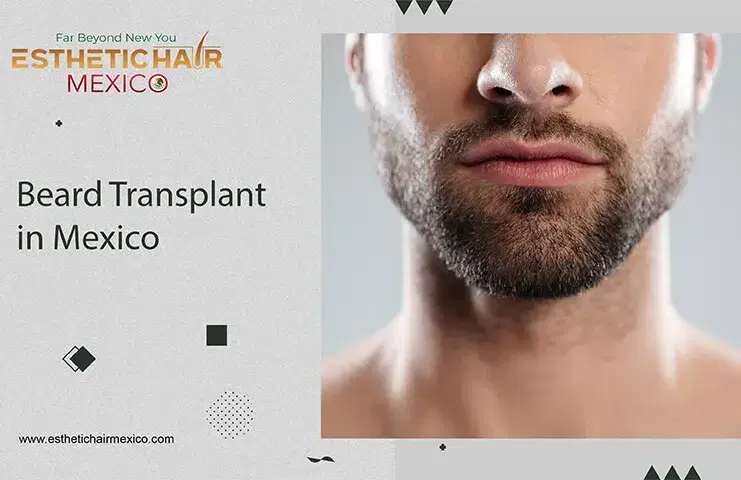 Beard Transplant Cost