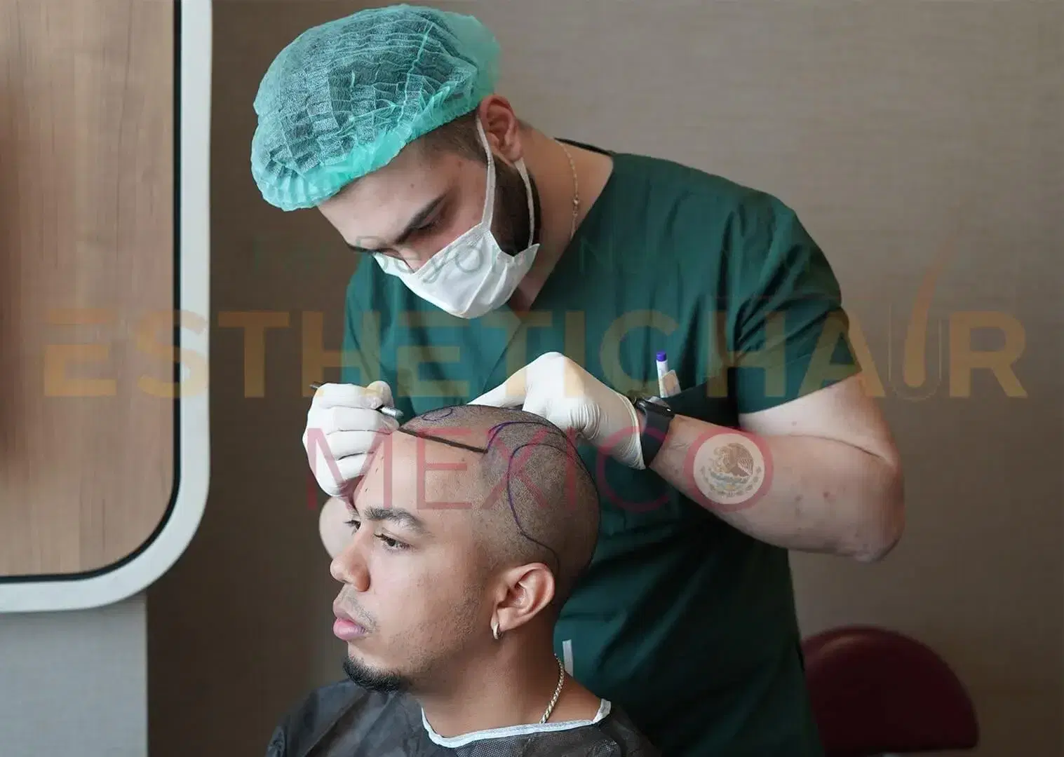 Precautions before Hair Transplant