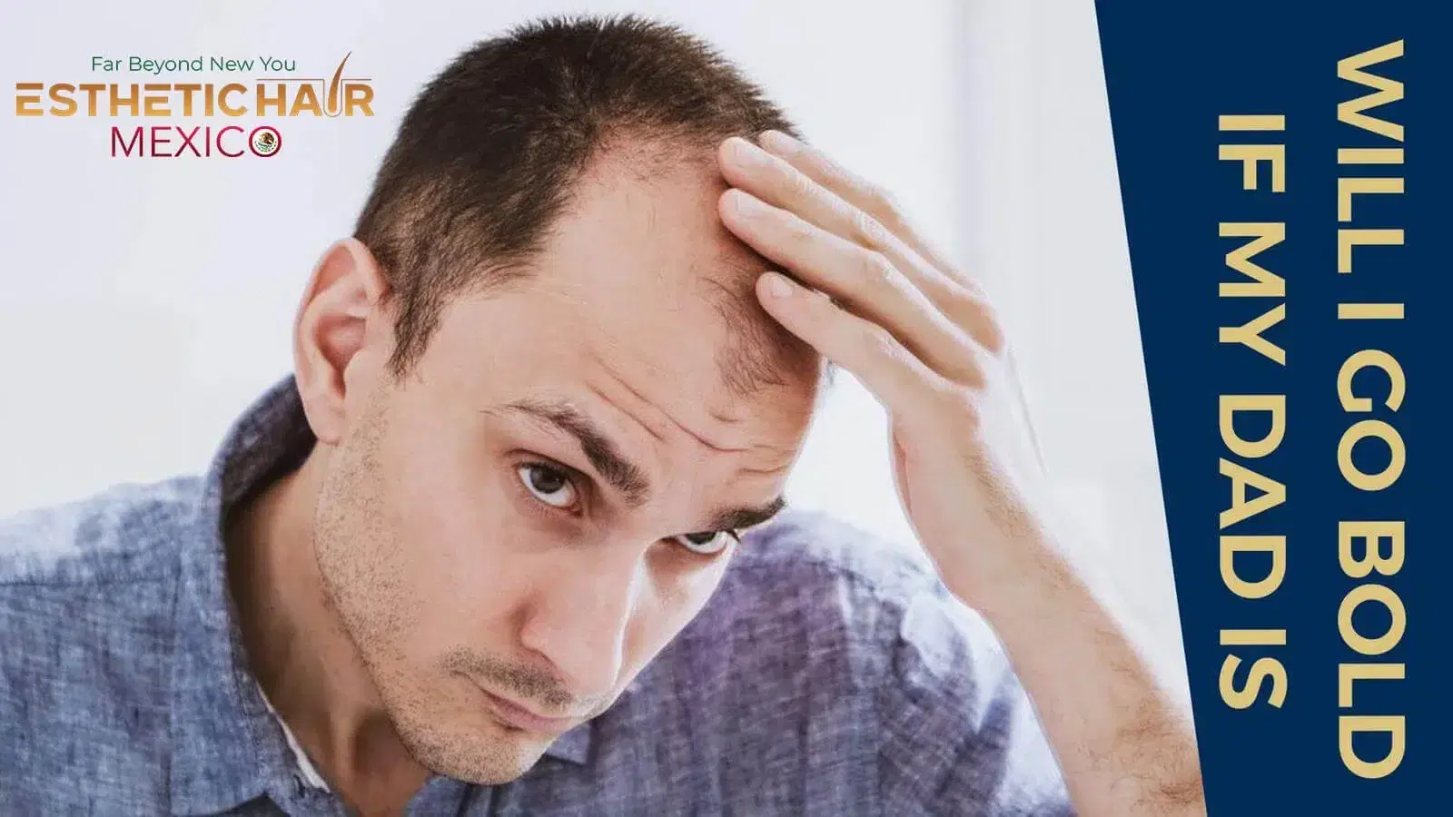 Will I Go Bald If My Dad Is