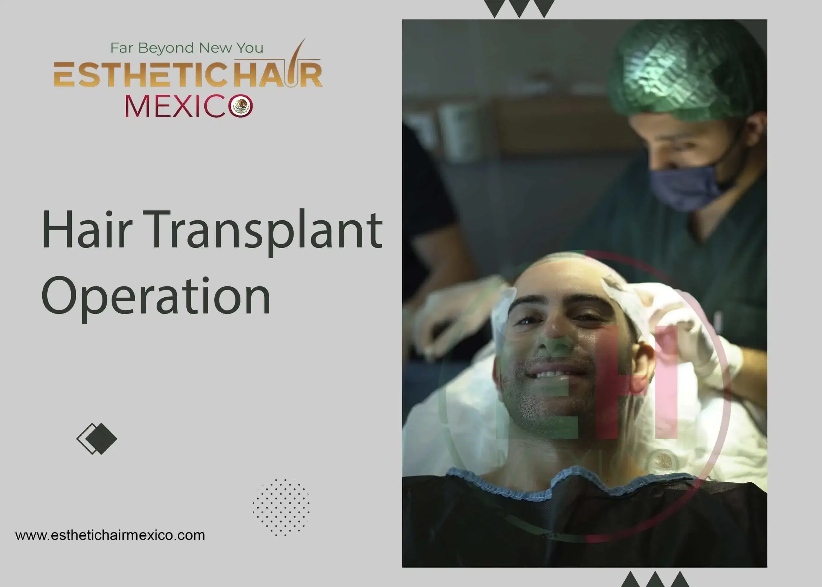 Hair Transplant Procedure Step by Step