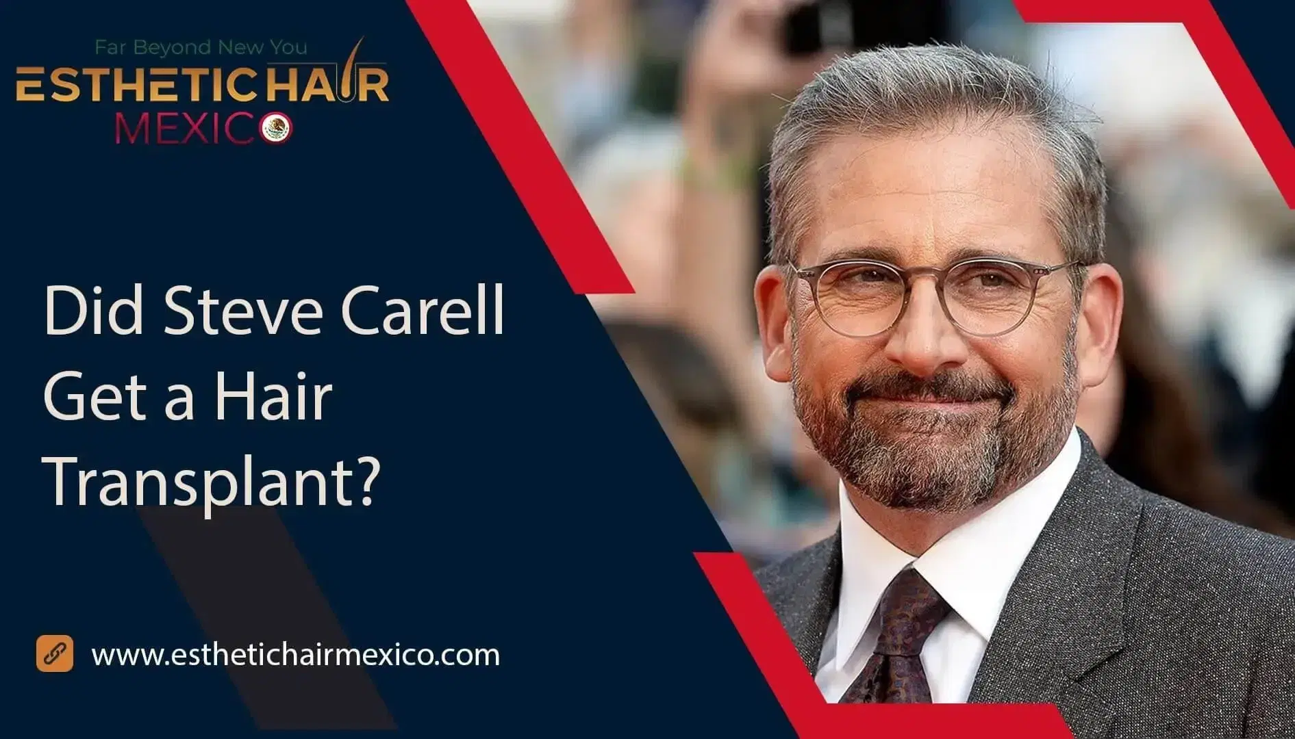 steve-carell-hair-transplant
